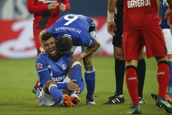 Schalke: Choupo-Moting muss passen - alle Stürmer fehlen