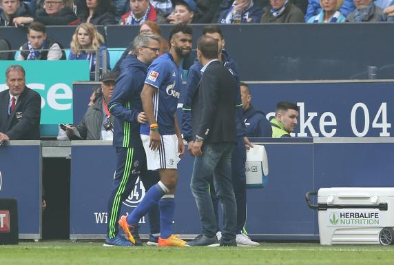 Schalke: Sorgen um verletzten Choupo-Moting