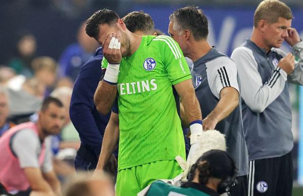 Schalke-Schock: Monatelange Pause für die Nummer eins